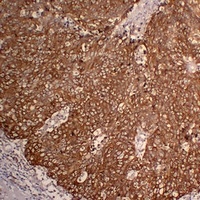 Anti-Cytokeratin 5 Antibody