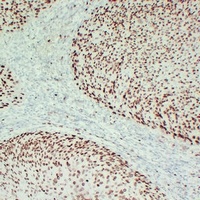 MCM2 antibody