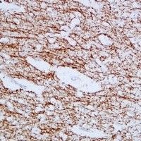 MBP antibody