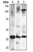 Nucleophosmin antibody