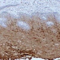 Anti-Annexin A1 Antibody