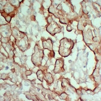 Anti-MUC16 Antibody