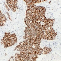 Cadherin pan antibody