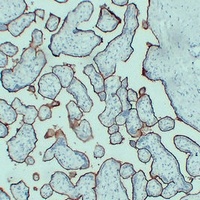 Anti-CD105 Antibody
