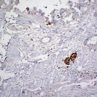 Chromogranin A antibody