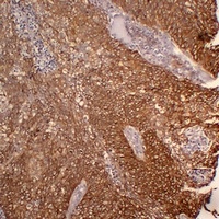 Anti-Cytokeratin 5 Antibody