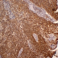 Cytokeratin 5 antibody