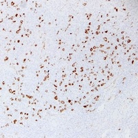 Anti-Fascin Antibody