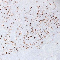 Fascin antibody