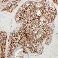 Anti-KSP Cadherin Antibody