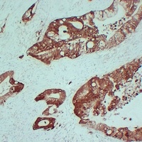 Anti-S100-A6 Antibody