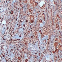 Thyroglobulin antibody