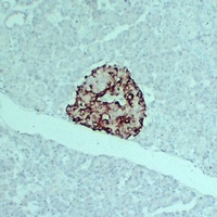 Anti-TIMP1 Antibody