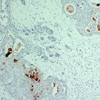 Anti-PIP Antibody