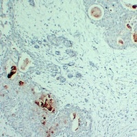 PIP antibody