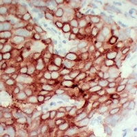 Anti-PS2 Antibody