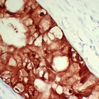 Anti-S100-A6 Antibody
