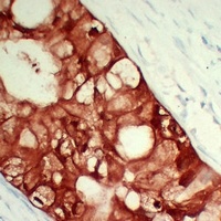 S100-A6 antibody