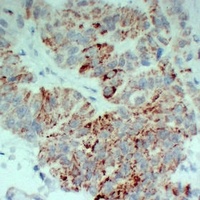Anti-TGFBR2 Antibody