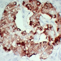 Anti-TIMP1 Antibody
