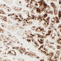 TMPase antibody