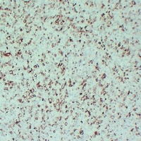Anti-STMN1 Antibody