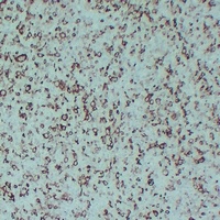 STMN1 antibody