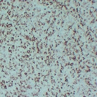 Anti-STMN1 Antibody