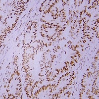 MSH2 antibody