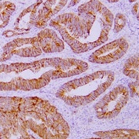 Catenin delta 1 antibody