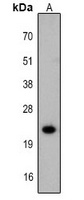 Anti-FTMT Antibody