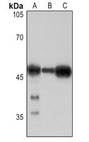 Anti-CD279 Antibody
