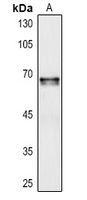 Anti-Cochlin Antibody