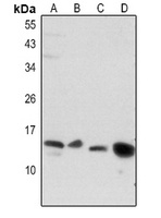 Anti-BNP Antibody