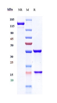 Anti-CAIX Reference Antibody (girentuximab-MMAE)
