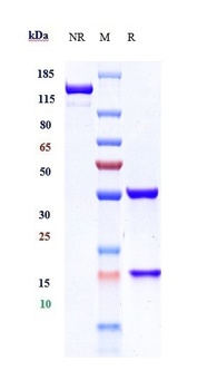 Anti-CAIX Reference Antibody