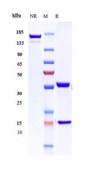 Anti-ERBB2 / HER2 / CD340 Reference Antibody