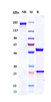 Anti-CEACAM5 / CEA / CD66e Reference Antibody (labetuzumab govitecan)