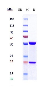 Anti-IL-21 Reference Antibody (avizakimab)