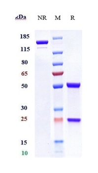Anti-CA9 / Carbonic anhydrase 9 Reference Antibody (girentuximab)