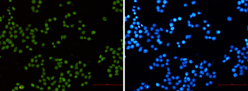 MLH1 Rabbit mAb