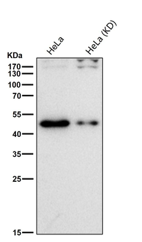 TDP 43 Rabbit mAb