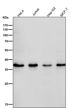 Rad51 Rabbit mAb