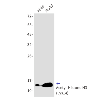 Acetyl-Histone H3 (Lys14) Rabbit mAb