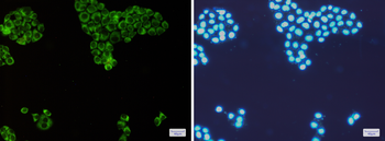 PKR Rabbit mAb