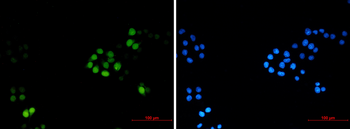 TPX2 Rabbit mAb