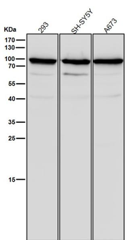 SCIN Rabbit mAb