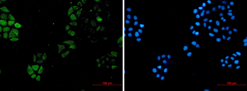 S100A4 Rabbit mAb