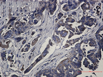 RSK1 p90 Rabbit mAb