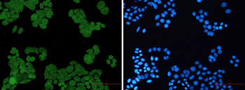 PP2A alpha/beta Rabbit mAb